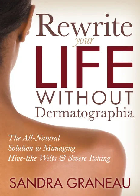 Rewrite Your Life Without Dermatographia: The All-Natural Solution to Managing Hive-Like Welts and Severe Itching - Paperback