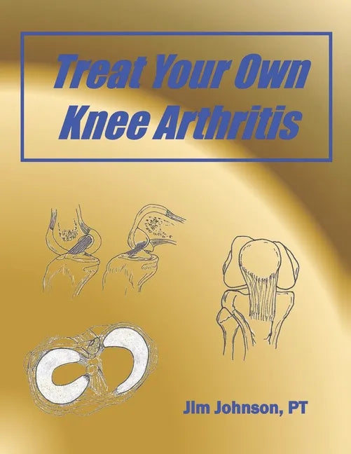 Treat Your Own Knee Arthritis - Paperback