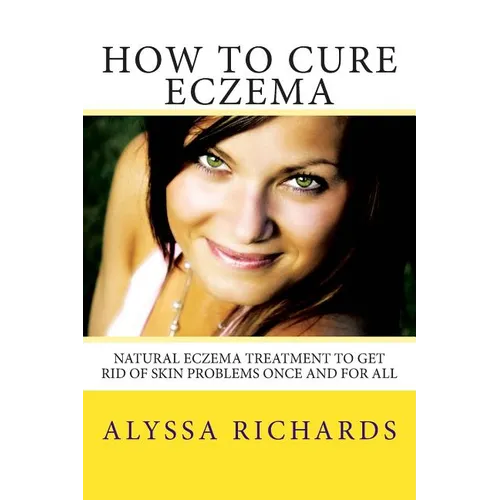 How To Cure Eczema: Natural Eczema Treatment To Get Rid Of Skin Problems Once And For All - Paperback