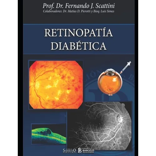 Retinopatía diabética: Oftalmología - Paperback